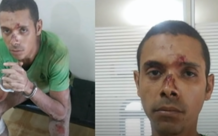 Ladrão é atacado por cães que protegem casa de senhora de 70 anos e dep…Veja o vídeo