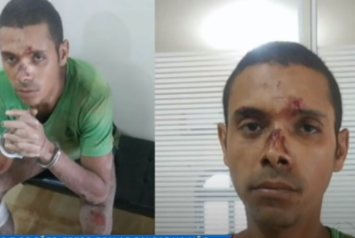 Ladrão é atacado por cães que protegem casa de senhora de 70 anos e dep…Veja o vídeo